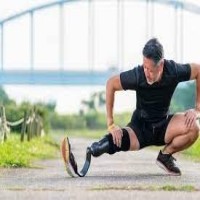 Luxmed prosthetic  Get prosthetic running leg in Iran